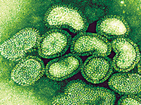 Gripe suína: Organização Mundial de Saúde aumenta nível de alerta