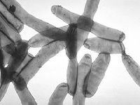 Póvoa de Varzim e Vila do Conde - Os Verdes Exigem Medidas Preventivas para Controlo do Surto de Legionella. 34355.jpeg Póvoa de Varzim e Vila do Conde - Os Verdes Exigem Medidas Preventivas para Controlo do Surto de Legionella. 34355.jpeg