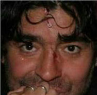 Maradona se fere em festa de Big Brother (foto)
