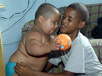 Bebê brasileiro de 15 meses pesa 25 quilos