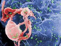 ONU: A meta &eacute; intensificar a luta contra o VIH. 35534.jpeg