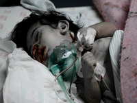 Gaza: Relatórios dos hospitais mostram terríveis cenas de vítimas civis