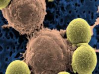 Leucemia: Nanotecnologia aumenta a sobreviv&ecirc;ncia. 17674.jpeg