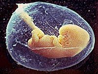 Um em cada 30 fetos abortados nasce vivo