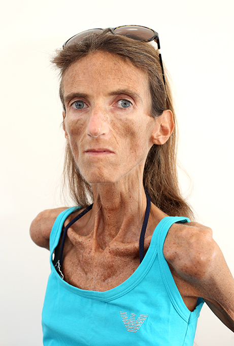 A mulher mais marga do mundo