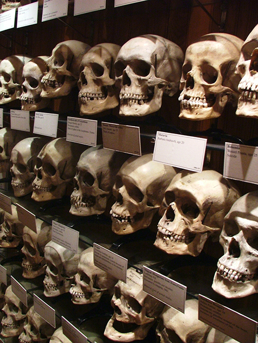 Museu Mutter não é para os fracos de coração
