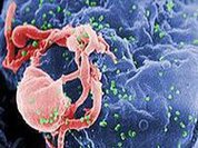 HIV: Infectos caem no mundo, crescem no Brasil