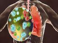 Coronavírus: Como enfrentar a pandemia?