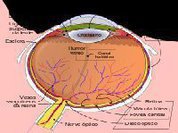 Implante corrige graves problemas de visão