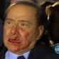 Ataque contra Berlusconi: Por quê é que as feridas mudaram de lado?