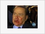 Ataque contra Berlusconi: Por quê é que as feridas mudaram de lado?