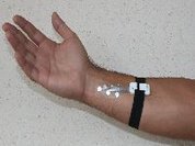 Tatuagens eletrónicas permitem monitorização da saúde