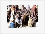 A UNICEF diz que 180.000 crianças são desnutridas na Somália
