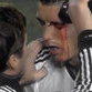 Cristiano Ronaldo sofre  lesão grave no olho